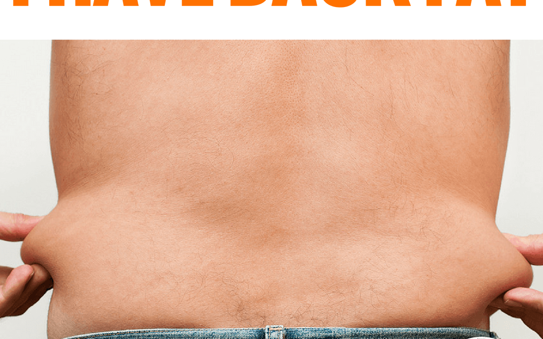 #87: I HAVE BACK FAT
