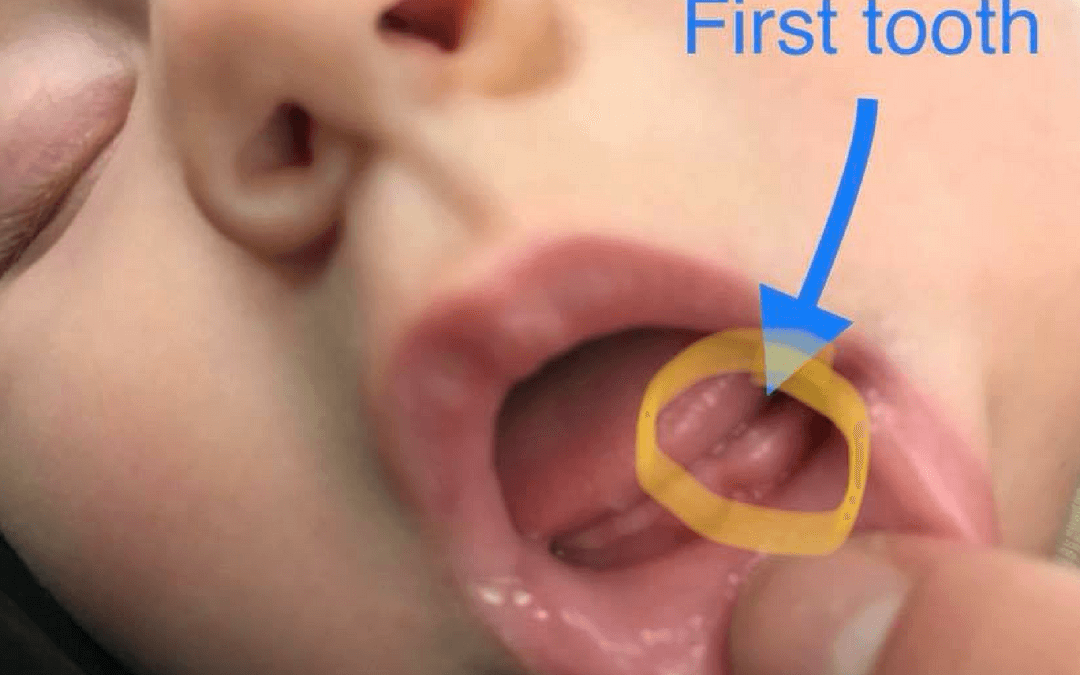 #120: MY SON’S FIRST TOOTH!